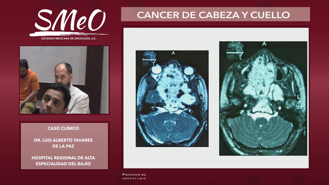 Luis Alberto Tavares De La Paz-6