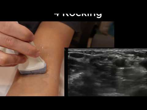 Ultrasound Probe/Transducer Movements and Manipulation Made EASY!