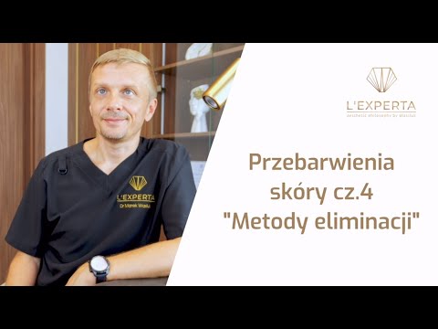 Przebarwienia skóry - jak usuwać?! | L'Experta