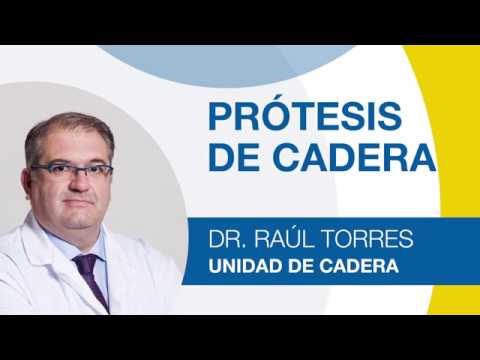 Tipos de Prótesis de Cadera