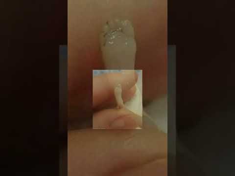 رفضت الام عملية الاجهاض و جت رسالة أن الجنين يكون مكتملا رغم صغر حجمه ووزنه