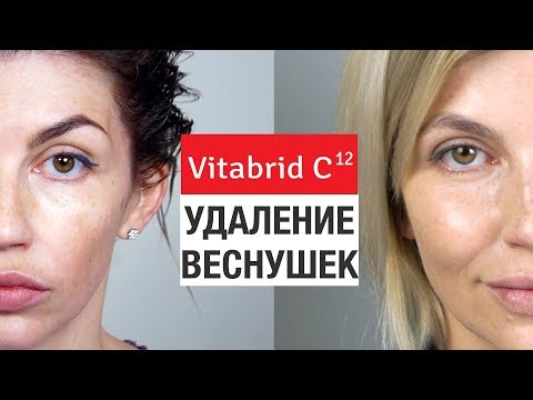 Пигментация на лице масло У меня веснушки что мне делать