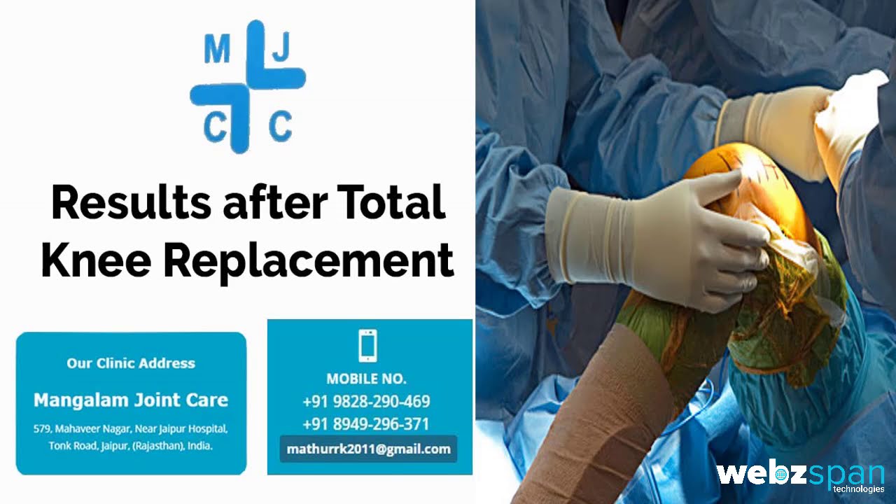 Total Knee Replacement  by  Dr R K Mathur ,Jaipur /घुटना प्रत्यारोपण ऑपरेशन के पहले और ऑपरेशन के बाद