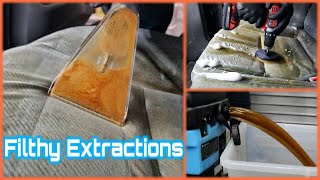 Simply EXTRACTIONS | FILTHY Deep Cleaning Compilation Ep1