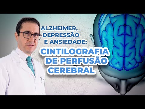 Cintilografia de Perfusão Cerebral | Alzheimer | Depressão | Ansiedade | IMEB