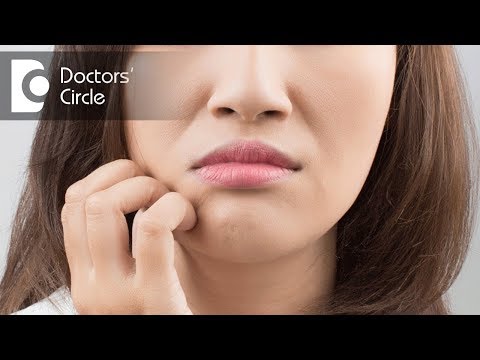 Topical steroid abuse in India - Dr. Madhu SM