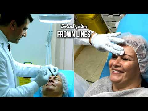 Botox Injection in Frown Lines - with Dr Allen Rezai