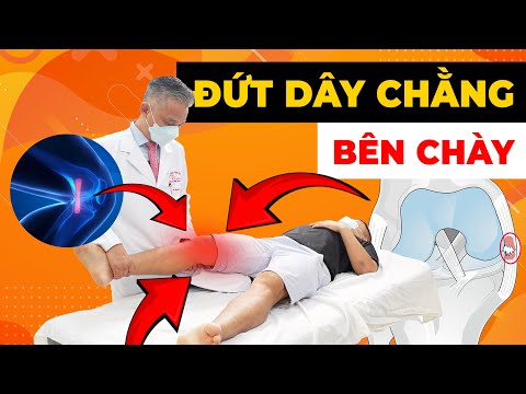 Tổn Thương Dây Chằng Bên Chày: Đừng Để Cơn Đau Hủy Hoại Cuộc Sống Của Bạn!