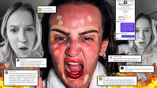 ANOTHER Mikayla Nogueira Private DM Leaked EXPOSING Her LIES | She's PISSED