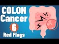 Colon Cancer 6 EARLY Symptoms Why They Occur Colon Cancer Symptoms Colorectal Cancer