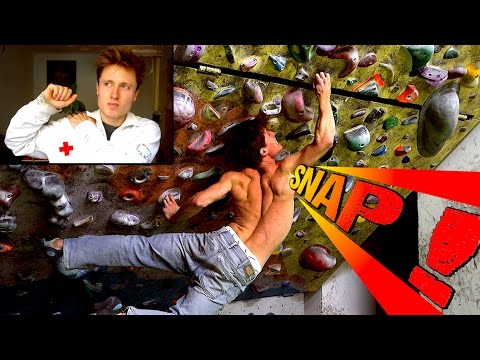 Climbing Related Shoulder Injuries: Prevention