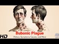 Bubonic Plague The Black Death