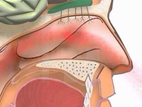 Vorgänge in der nase Animation