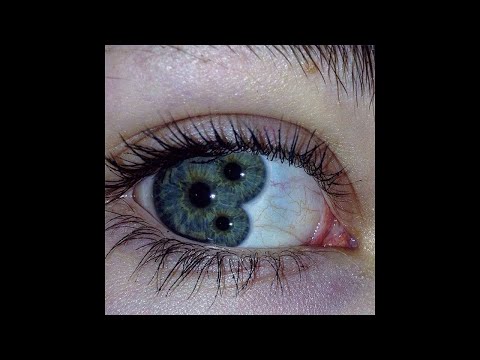 [SOLD] Electro Punk x Ho99o9 x Crystal Castles Type Beat - ‘GADGET’