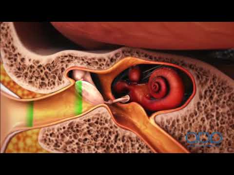 How the Ear Works -  3D Medical Animation || ABP ©