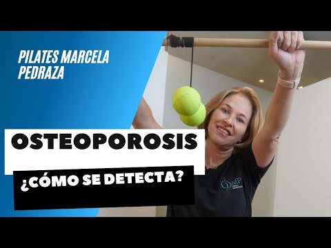 OSTEOPOROSIS ¿CÓMO SE DETECTA?