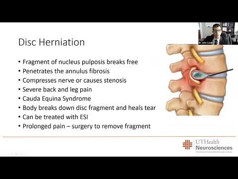 Low Back Pain and Spinal Deformity with John Caridi, MD.