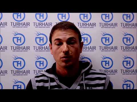 Пациент разказва за присаждане на коса в Турция – естествен резултат