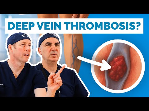 Do You Have A Blood Clot Or DVT? Signs & Symptoms