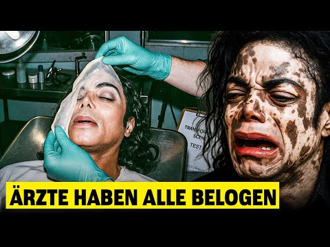 Michael Jacksons Hautfarbenveränderung War Nicht Das, Was Sie Denken – Sie War Sein Tod?