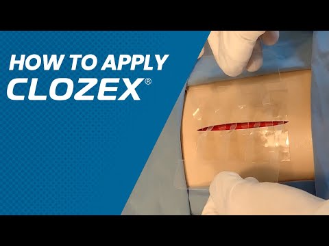 How To Apply Clozex®
