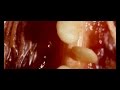 Dusky - Skin Deep (Official Video)