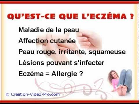 comment soulager l'eczema naturellement