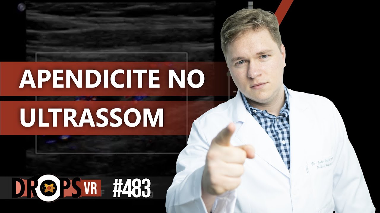 APENDICITE NO ULTRASSOM - VOCÊ SABE RECONHECER?