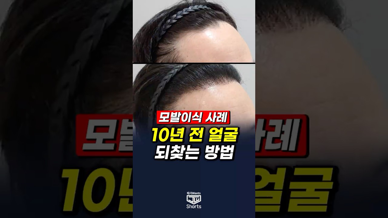 더원츠의원 숏폼