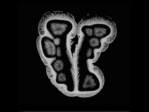 Via Dacă - Mă uitai la răsărit (Official Music Visual)