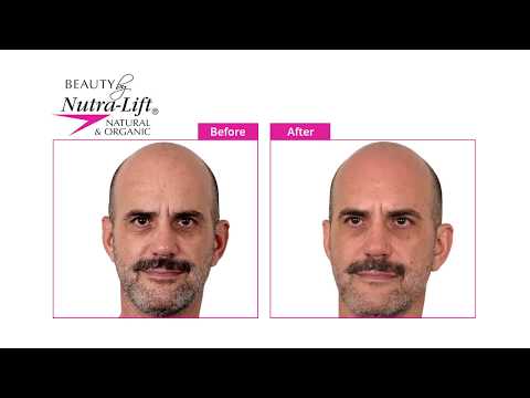 Nutra-Lift® Instant Results with More Moisture 59 ml