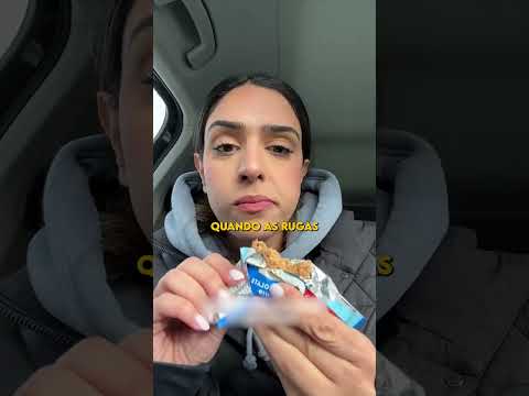 Você aplicaria botox em qual região do rosto? #botox #tratamento #rugas
