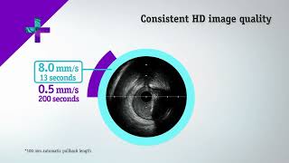 The AVVIGO™+ Multi Guidance System: System Overview