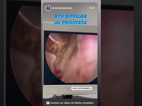 Victor Gomes Barboza-24