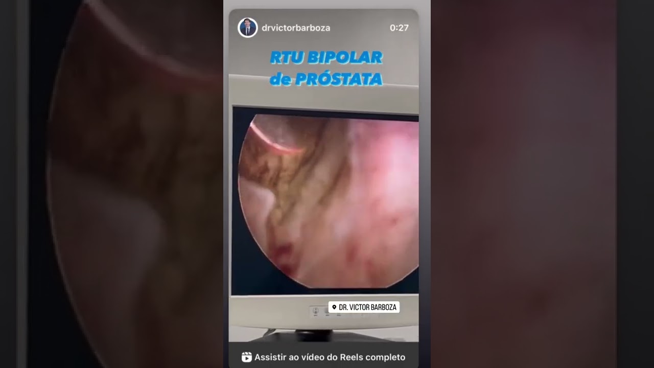 Victor Gomes Barboza-24