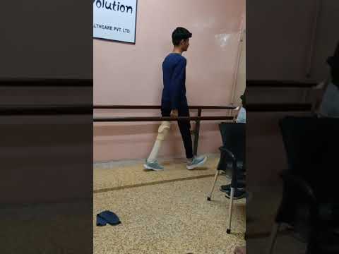 Evolution healthcare Functional Prosthetic Promoned Foot, Thickness: 8mm, leg prosthesis