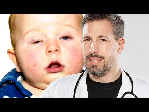 COMMENT VAINCRE LA GUEULE DE BOIS