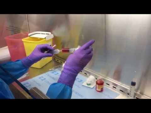 DC Bead Loading (Doxorubicin)