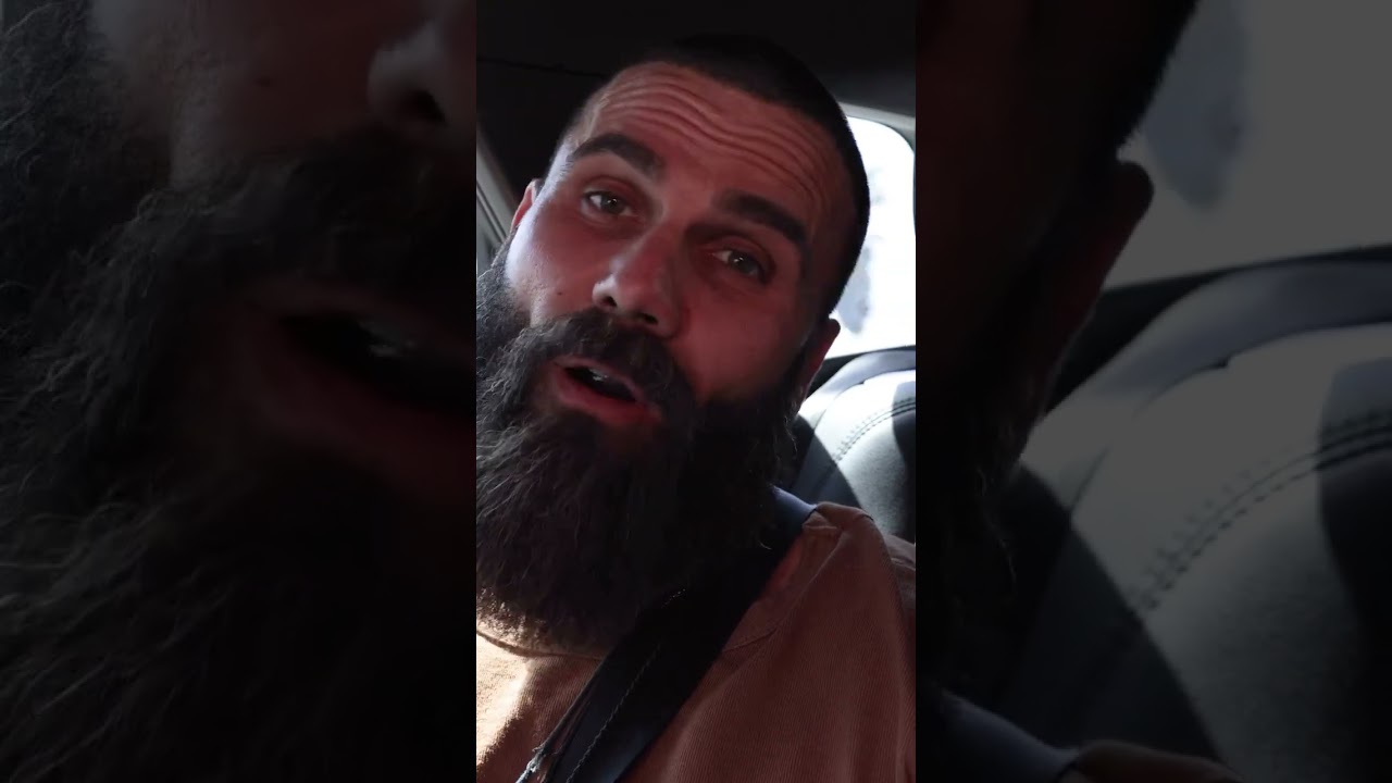 From Hollywood Waves to Tijuana Wonders: Jeremy's Hair Transplant Experience! | Hairfix México