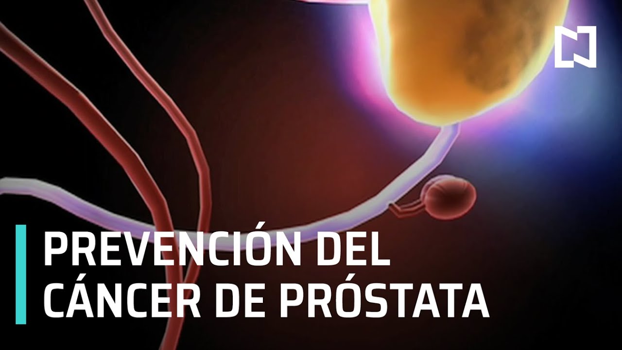 Ulises Sanchez Aquino-8