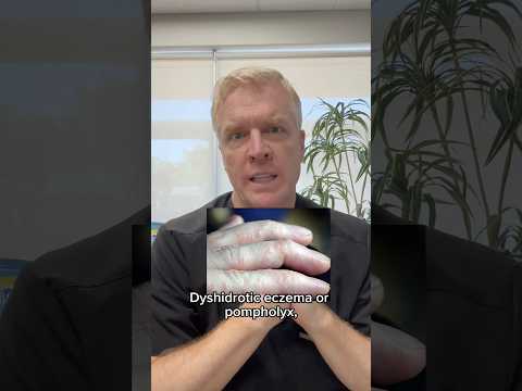 Dyshidrotic Eczema