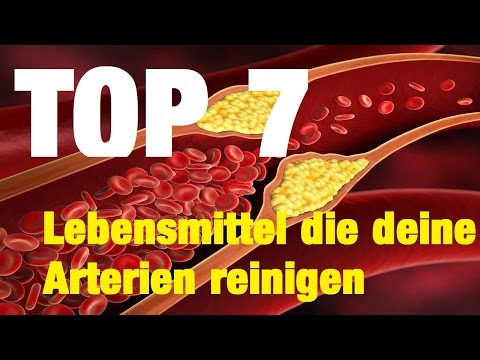 Prostatamassage Meinung Celandine Tinktur in Wodka für Prostatitis