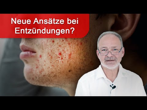 , title : 'Entzündungen natürlich behandeln - neue Studien und Therapieansätze!'