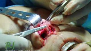 NassifMD Plastic Surgery