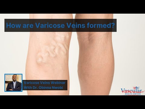 Picioarele de bobinare în varicoză, Tipuri de bandaje elastice pentru tratamentul varicelor