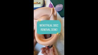 Download lagu Quick menstrual disc removal demo ✨ mp3