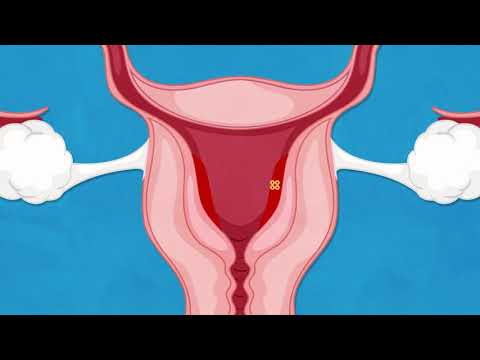 How does mifepristone work?