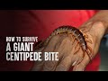 How To Survive A Giant Centipede Bite