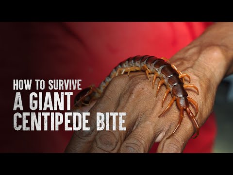 How to Survive a Giant Centipede Bite