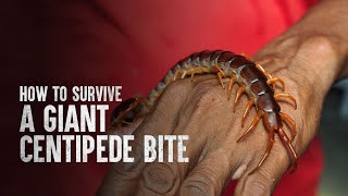 How to Survive a Giant Centipede Bite